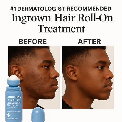 Rhóms Smoothing Solution