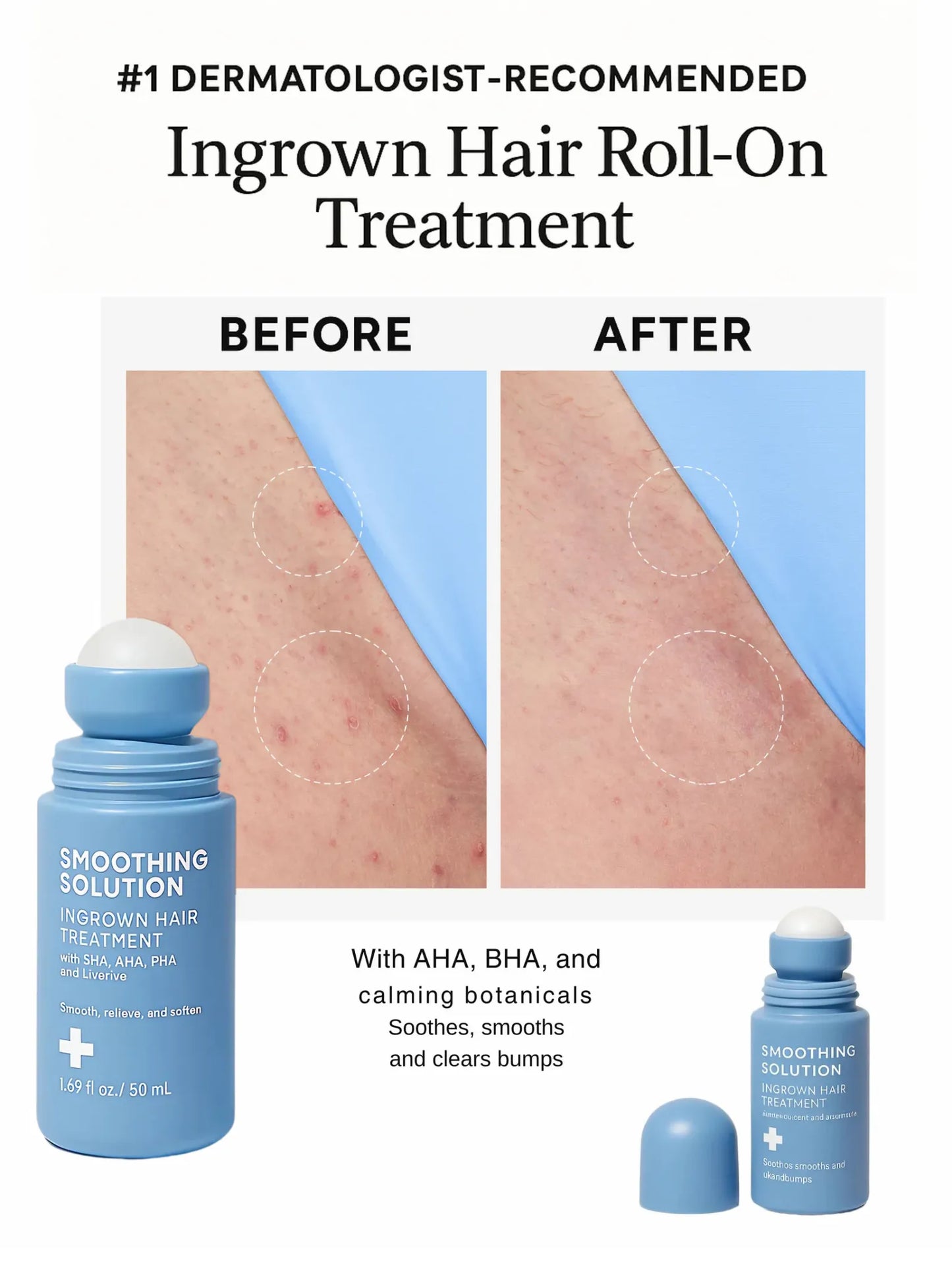 Rhóms Smoothing Solution