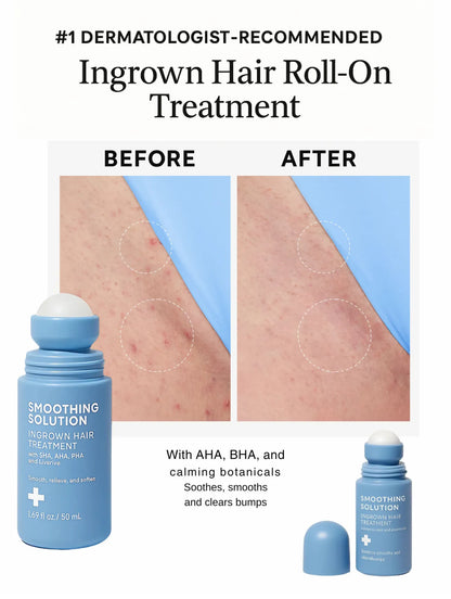 Rhóms Smoothing Solution