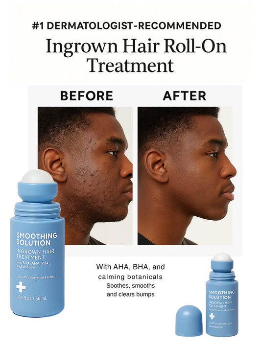 Rhóms Smoothing Serum (FREE GIFT)