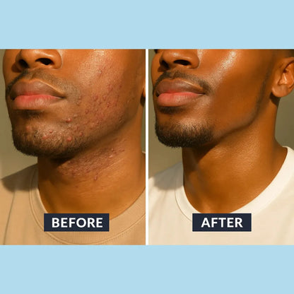 Rhóms Smoothing Solution™