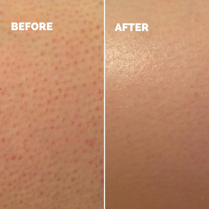 Rhóms KP Smoothing Solution